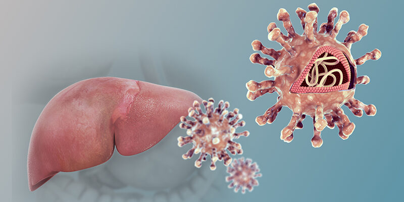 Hepatitis C