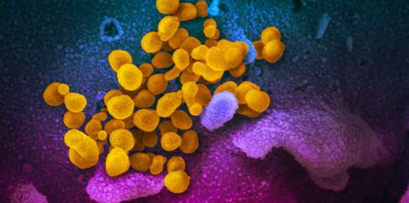 Coronavirus Source NIAID