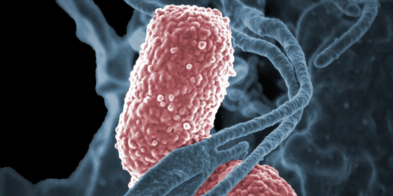 Klebsiella Photo NIAID